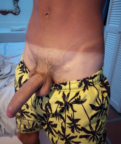 Big cock and a sunburn